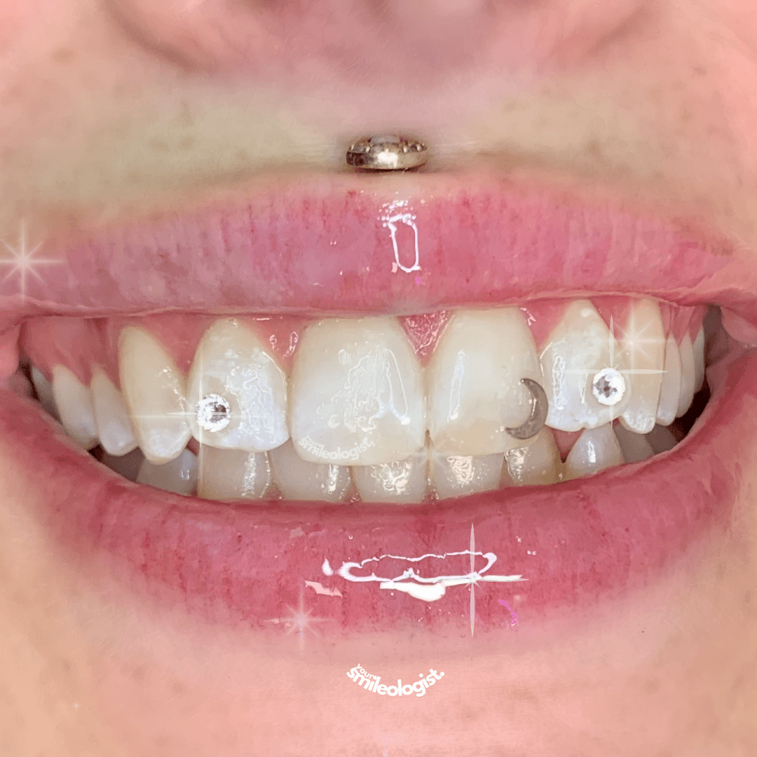 The Complete Tooth Gem Aftercare Guide