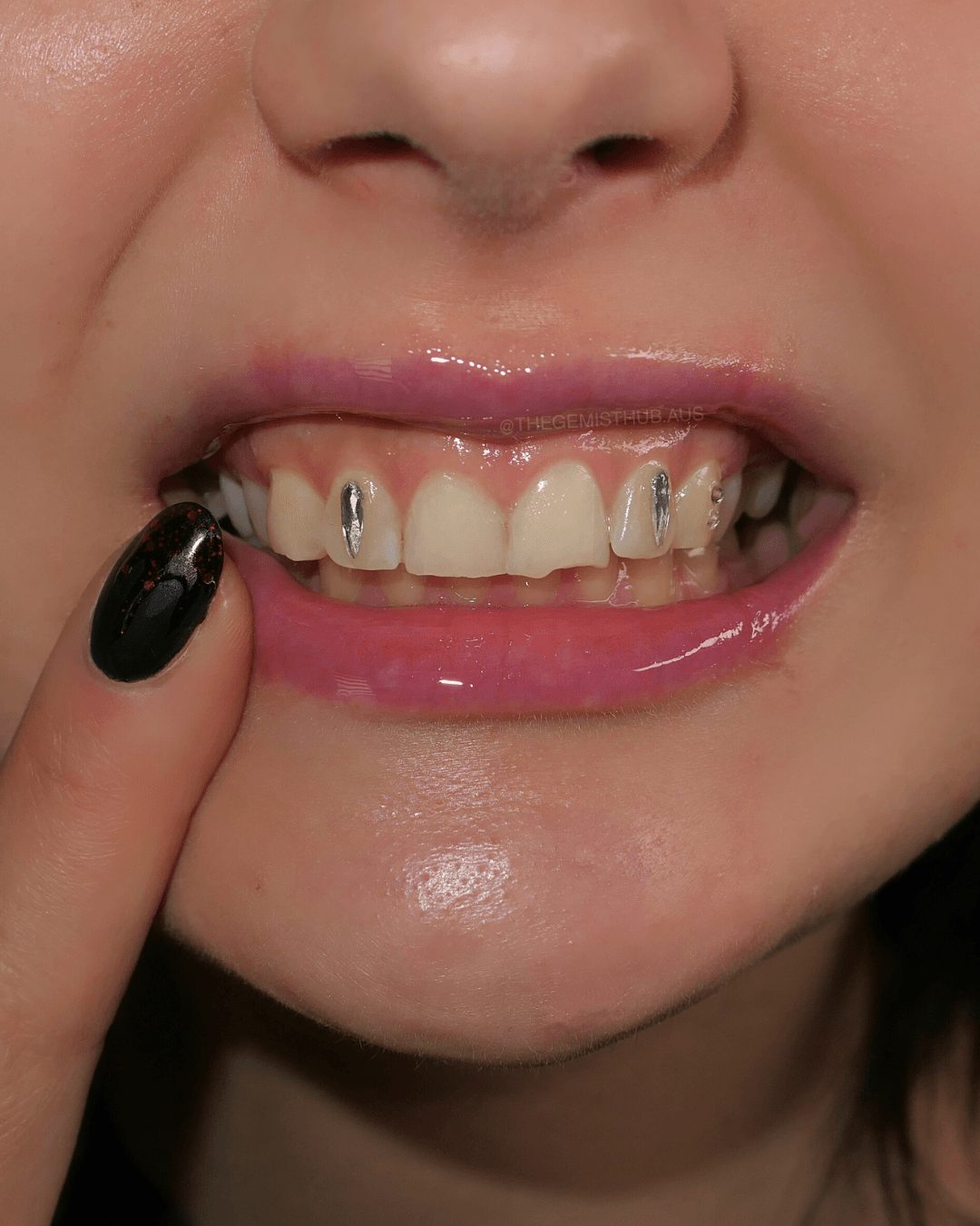 What Are Tooth Gems? Everything You Need to Know