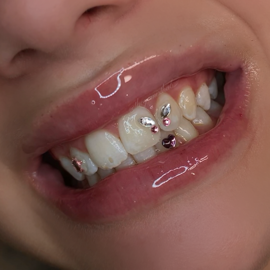 Tooth gem training and education