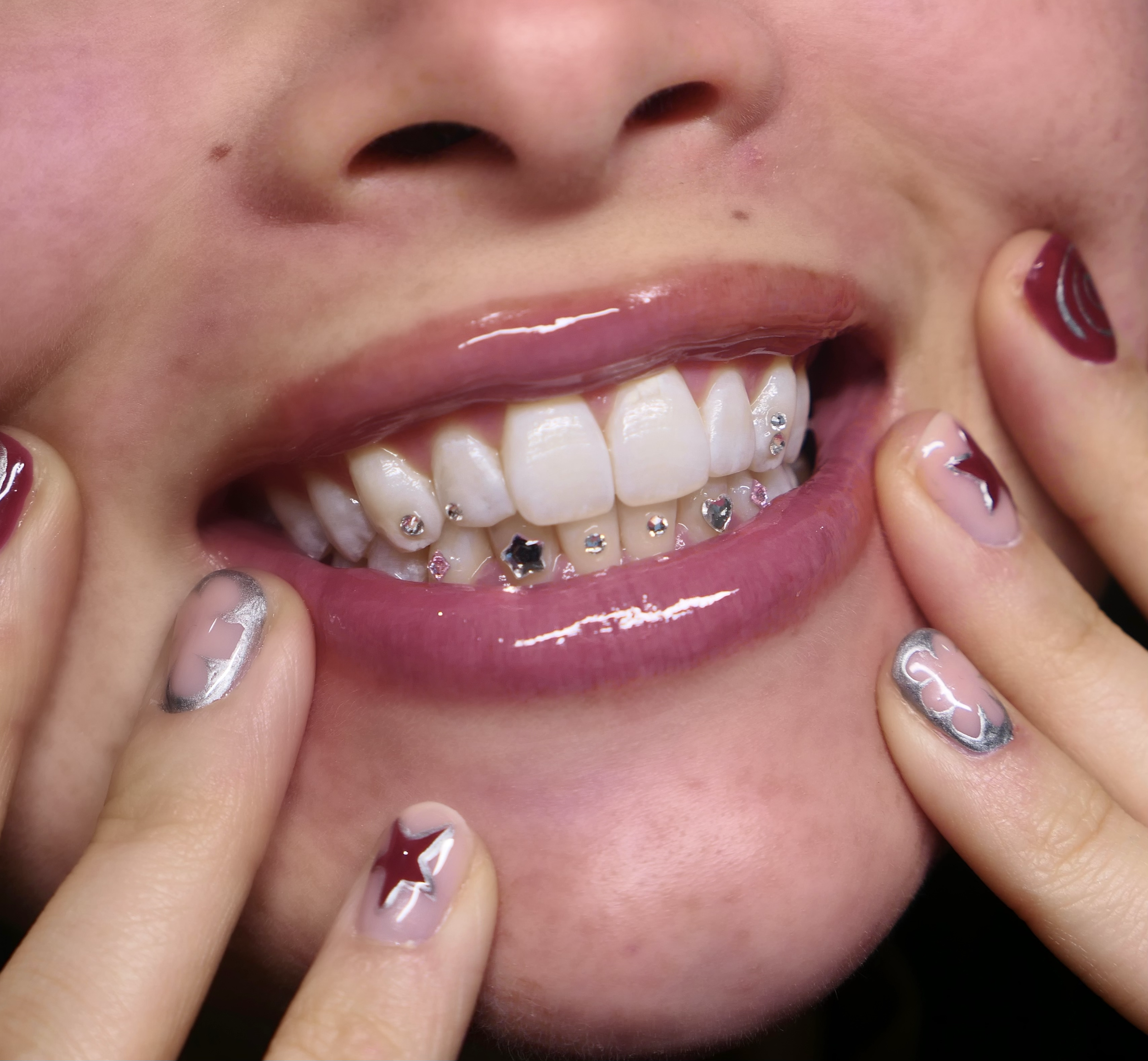 Bright smile for a special occasion