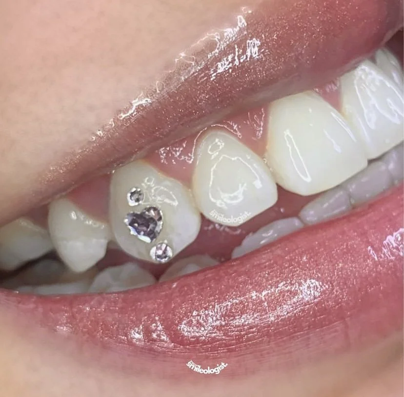 Professional dental tools for tooth gem application